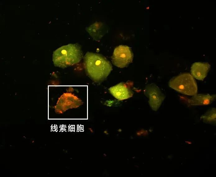 1749518478696651.jpg abba565e95b0ee1d182230ce2f0e8985.jpg