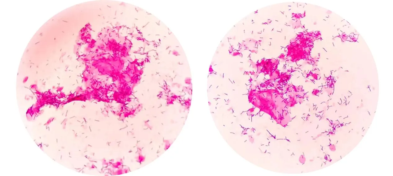 1750819248706005.jpg 94b4438f2788bfe16ed40ede04ba2c3f.jpg